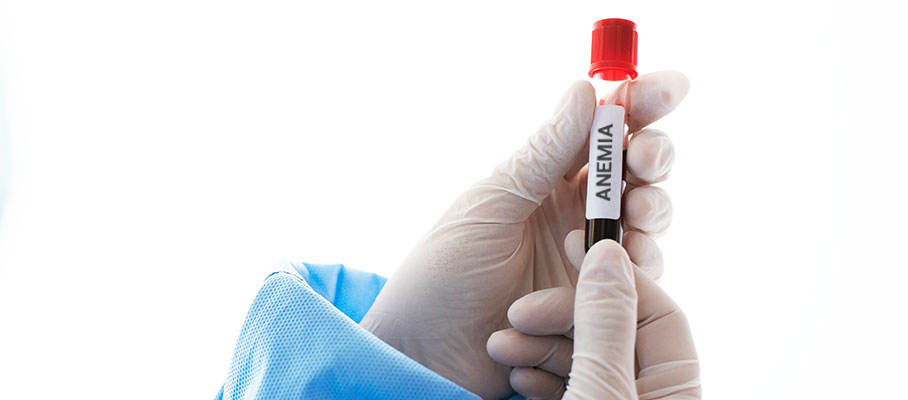 Anemia Check Up