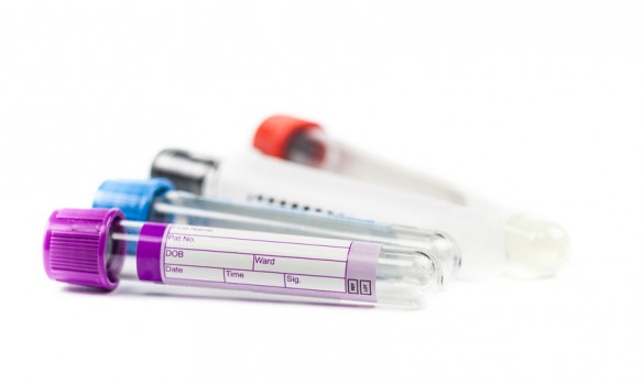 Hormone testing