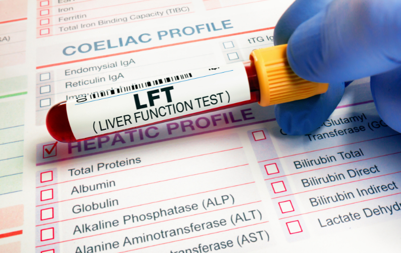 Liver Function Test